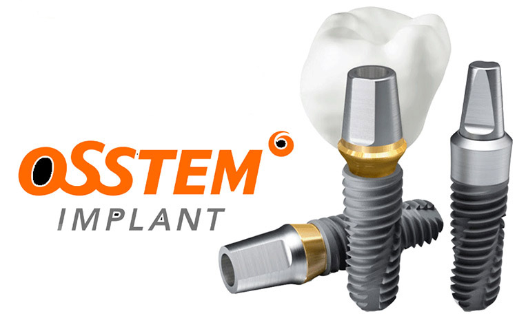 Trồng răng Implant Osstem